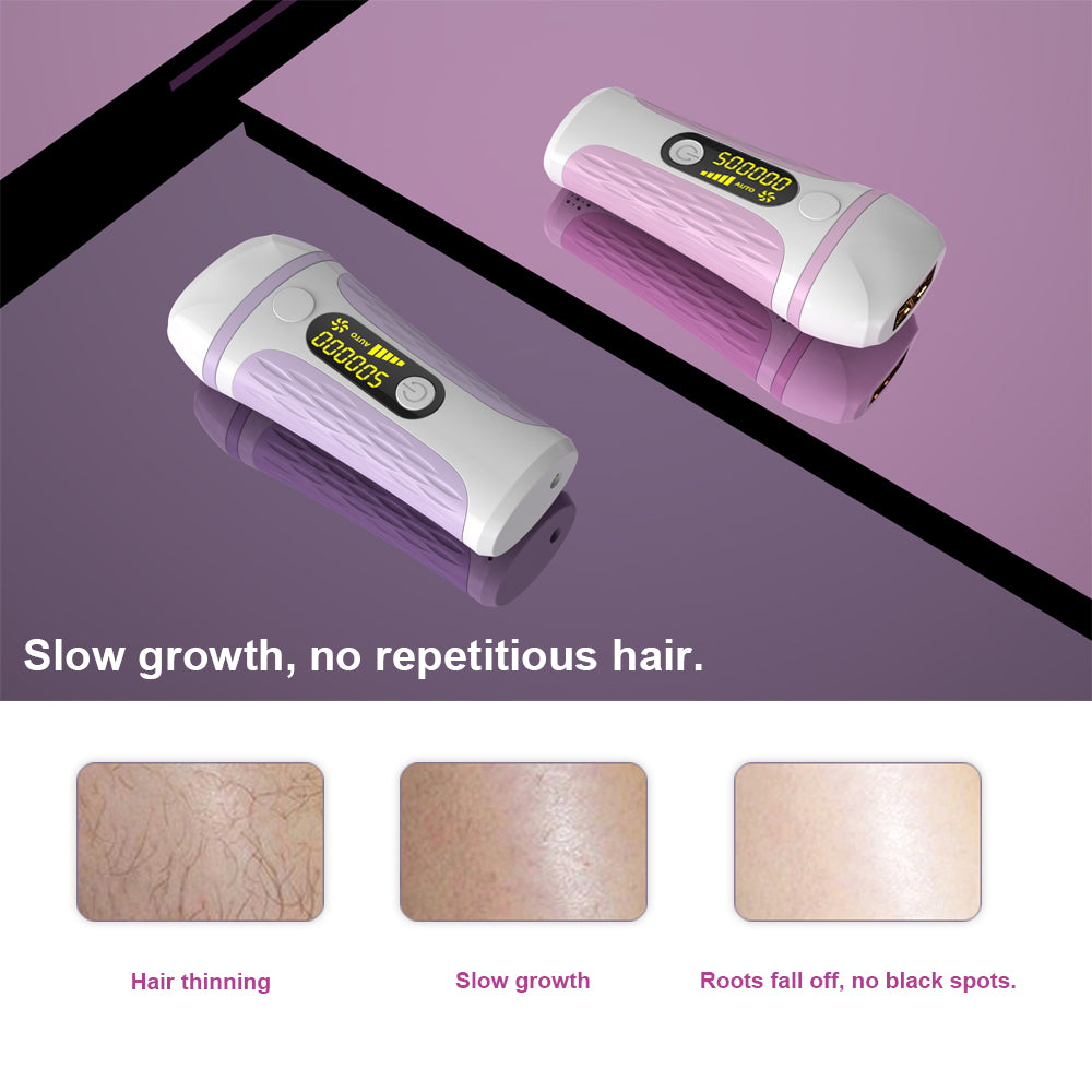 IPL laser hair remover - LoKeyHigh Variety shop